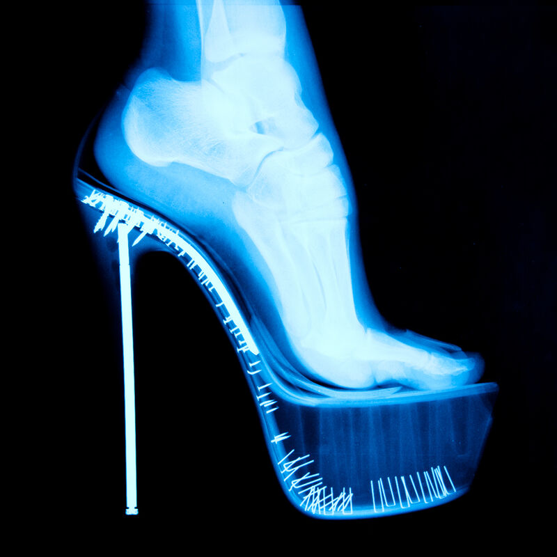 Tyler Shields, ‘X-Ray High Heel’, 2012, Photography, Chromogenic Print on Kodak Endura Luster Paper, Isabella Garrucho Fine Art
